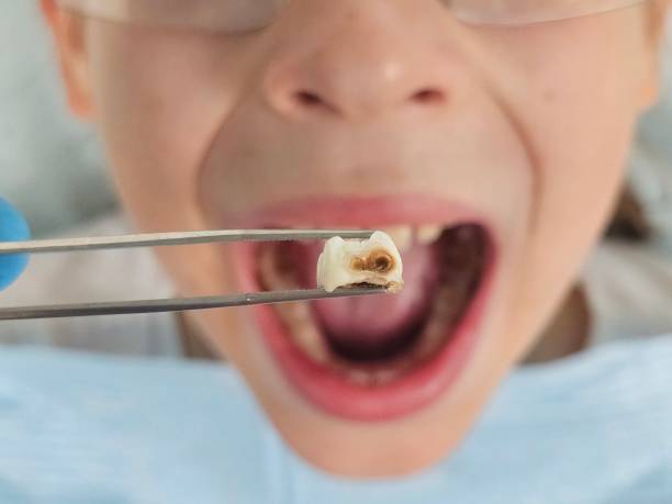 Best Tooth Pain Emergency Relief  in Marion Oaks, FL